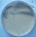 CHROMagar Salmonella. Medio de cultivo cromogénico para la detección de Salmonella.