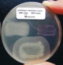 CHROMagar Ident Listeria. Medio de cultivo cromogénico para la Identificacion de Listeria.
