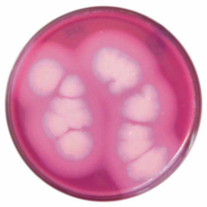 Bacillus cereus, Agar Base