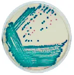 CHROmagar™ C3Gr. Chromogenic medium for overnight detection of beta-lactamase producing Enterobacteria achieving third generation cephalosporin resistance.