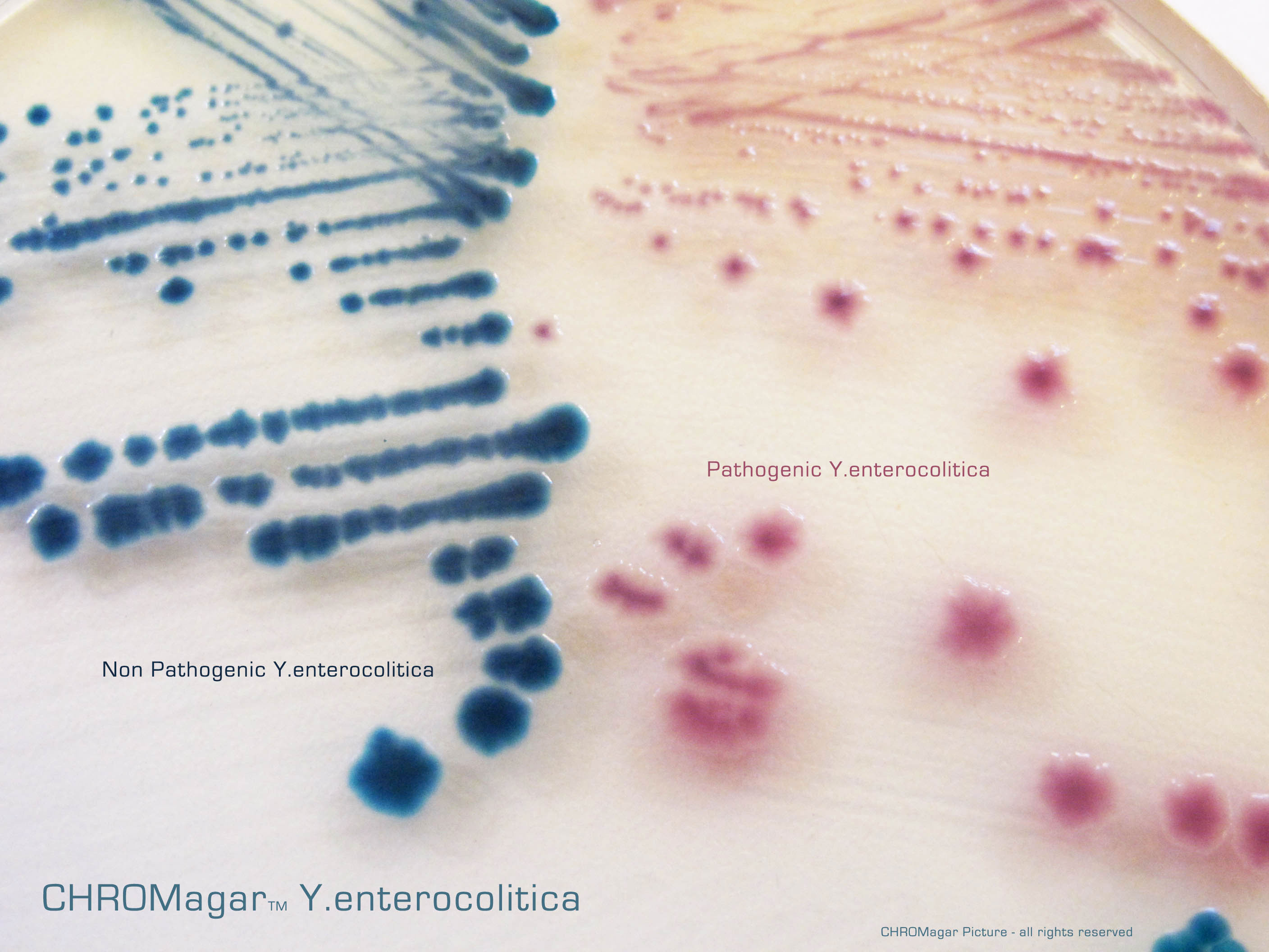 CHROMagar™ Yersinia Enterocolitica. Chromogenic medium for detecton and differentaton of pathogenic Yersinia enterocolitica.