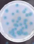 CHROMagar™ Pseudomonas. Chromogenic medium for isolation and detection of Pseudomonas species.
