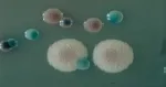 CHROMagar™ Candida. Chromogenic medium for the detection of Candida spp.