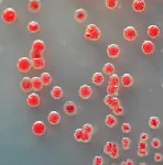 CHROMagar™ Acinetobacter. Chromogenic medium for detection of Acinetobacter and MDR Acinetobacter sp.