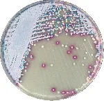 CHROMagar™ Malassezia. Chromogenic medium for detection of Malassezia spp.