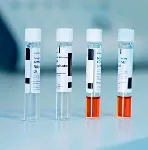 Photometric analysis. LOVIBOND®. Reactives for Lovibond® equips. Description: COD MLR. Detection range: 15-300mg/l O2. Number of pills, tests or ml: 25