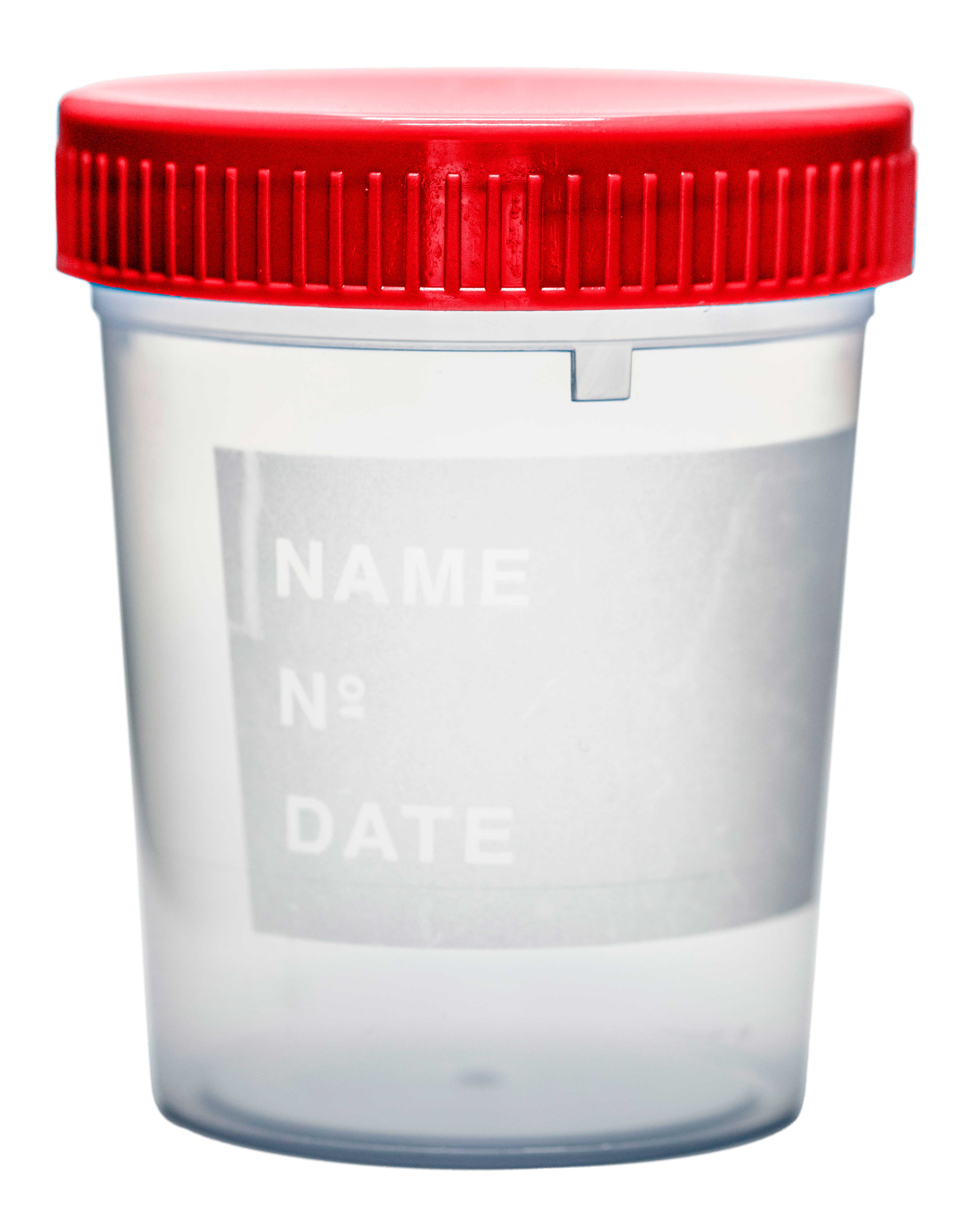 Urine container sterile graduated. Individually wrapped. Vol: 150 ml.  Measure:  up to 100ml. Cap color: Red. Material: PP. Writing surface: Yes. Dim: 58 x 72 mm. Graduation marks at (mL): 20, 40, 60, 80, 100.