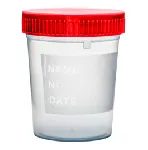 Urine container sterile graduated. Individually wrapped. Vol: 150 ml.  Measure:  up to 100ml. Cap color: Red. Material: PP. Writing surface: Yes. Dim: 58 x 72 mm. Graduation marks at (mL): 20, 40, 60, 80, 100.