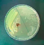 Oxidase Reagent. Reagent for the detection and verification of bacterial citochrome oxidase. 2 metallic bags with 25 swabs each. SCHARLAU