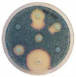 CHROMagar™ MH Orientation. Chromogenic Mueller Hinton medium