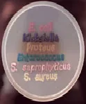 CHROMagar™ Orientation. Chromogenic medium for the isolation and differentiation of urinary tract pathogens.