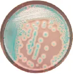 CHROMagar™ Bacillus cereus. Chromogenic medium for detection and enumeration of Bacillus cereus group in environmental and food samples.