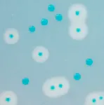 CHROMagar™ CCA. Chromogenic Coliform Agar for the detection and enumeration of ß-glucuronidase positive E. coli and other coliforms in water samples according to the ISO 9308-1 norm.