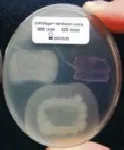 CHROMagar™ Identification Listeria. Chromogenic medium for confirmation of L.monocytogenes species from suspect colonies on CHROMagar Listeria.