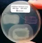 CHROMagar™ STEC. Chromogenic medium for detection of Shiga-Toxin producing E. coli (STEC).