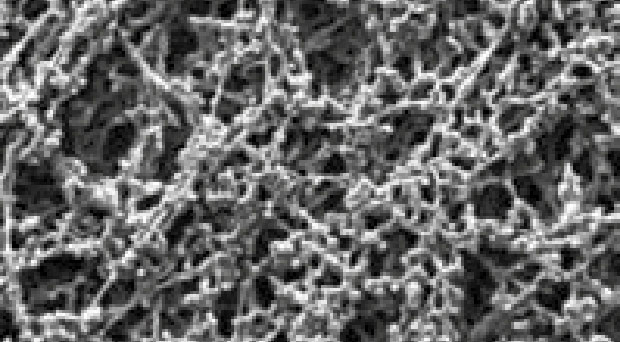 Cellulose Acetate (CA) Membrane AcetatePlusTM. GVS. Material: CA. ø (mm): 25. Pore size (µm): 0,45. Sterile: No. Grid: No. Colour: White