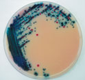Rambach™ Agar. For detection and isolation of Salmonella spp. Chromagar