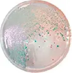 CHROMagar Vibrio. Medio de cultivo cromogénico para el Aislamiento y Diferenciacion de  especies de Vibrio.
