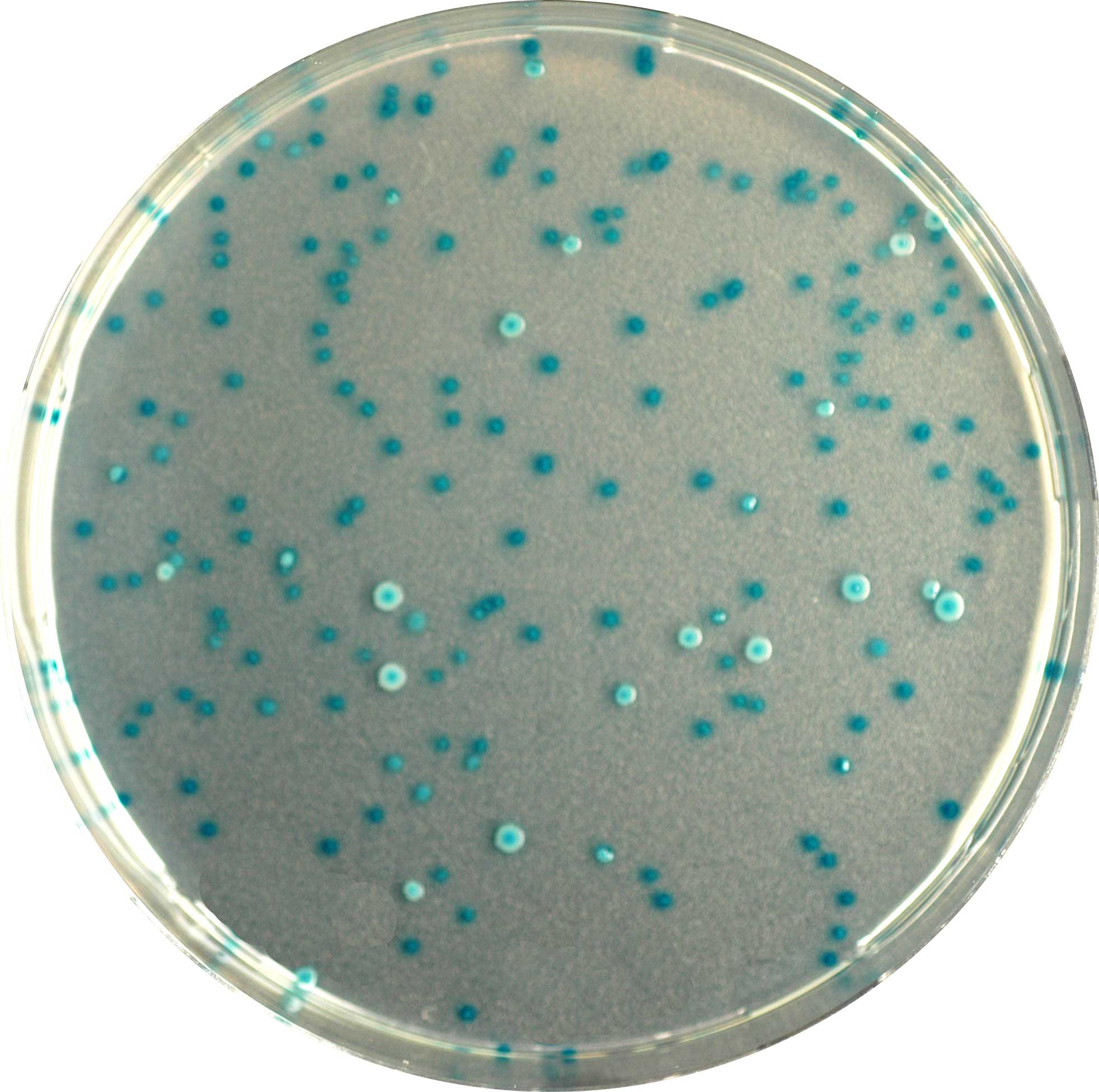 CHROMagar E. coli. Medio de cultivo cromogénico para la detección y recuento de E.coli.