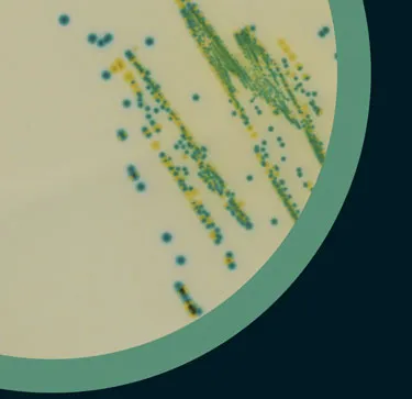 Colored colonies of microorganisms in Scharlau Microinstant® chromogenic medium