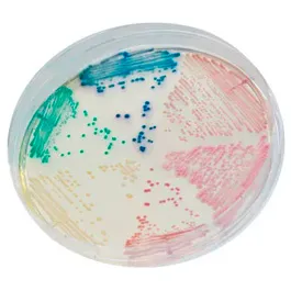 Growth of a CHROMagar™multicolour chromogenic culture medium  in a Petri dish