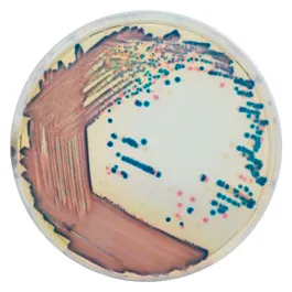 CHROMOGENIC MEDIA CHROMagar™