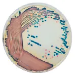 CHROMagar™ COL-APSE