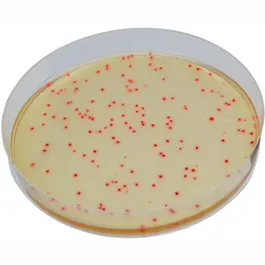 CHROMOGENIC MEDIA CHROMagar™