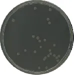 Scholten's Agar modified