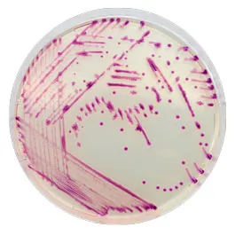 CHROMOGENIC MEDIA CHROMagar™