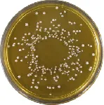 APT Agar