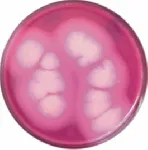 Bacillus cereus Agar