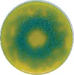 Bacillus cereus Selective Agar
