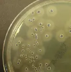 Baird Parker RPF Agar