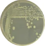 BAT Agar