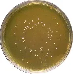 Brain Heart Infusion Agar (BHI Agar)