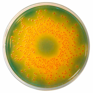 38: Ttc Motility Agar , Motility Test Medium Protocol – GBSORU