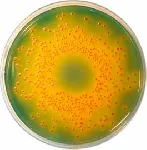 Chapman TTC Agar &#x0D;