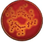 Blood Agar Base (Columbia)