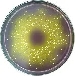 D/E Neutralizing Agar Base