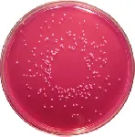 Dichloran Rose Bengal Chloramphenicol Agar