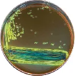 Eosin Methylene Blue Agar (EMB Agar)