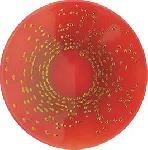 Endo Agar Base