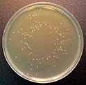 Microbial Content Test Agar