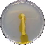 Phenylalanine Agar (PPA)&#x0D;