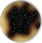 Kanamycin Esculin Azide Agar (KAA Agar) &#x0D;