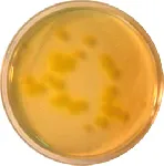 King B Agar (F Agar)