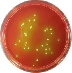 Chapman Agar (Mannitol Salt Agar)