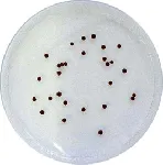 Nickerson Agar