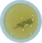 Plate Count Agar (PCA)